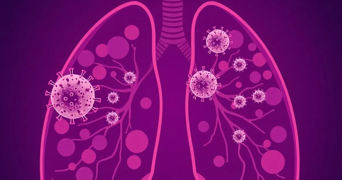 Influenza viral pneumonia - study with AI flashcards and spaced repetition